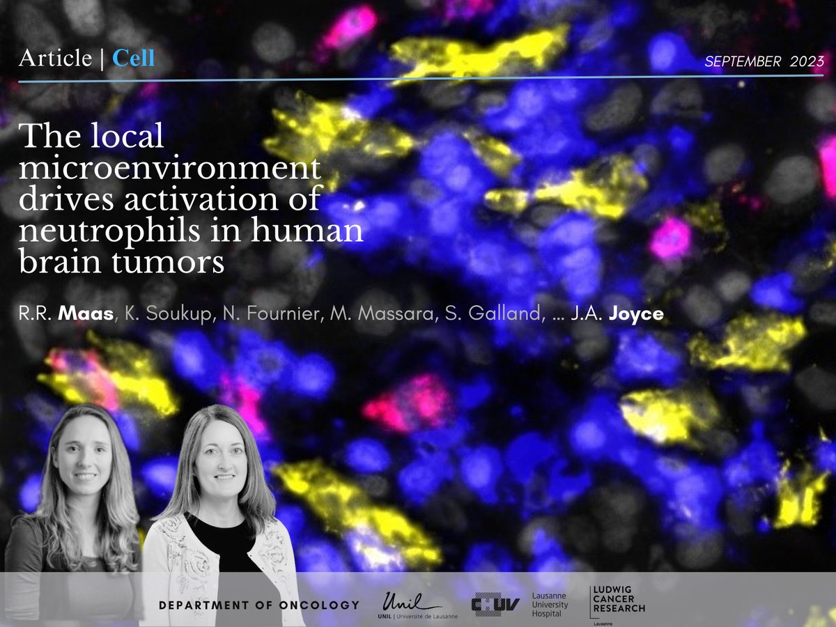 Oncology UNIL CHUV (@oncounilchuv) on Twitter photo 🔥NEW RESEARCH led by <a href="/RoeltjeMaas/">Roeltje_Maas</a> & <a href="/Johanna_A_Joyce/">Johanna Joyce</a> in <a href="/CellCellPress/">Cell</a> investigating the role of tumor-associated neutrophils (TANs) in brain tumor microenvironment.
🔗Read: doi.org/10.1016/j.cell…
➡️joycelab.shinyapps.io/braintime/
<a href="/unil/">Université de Lausanne</a> <a href="/FBM_UNIL/">Faculté de biologie et de médecine (inactif)</a> <a href="/Ludwig_Cancer/">Ludwig Cancer</a> <a href="/CHUVLausanne/">CHUV / Centre hospitalier universitaire vaudois</a> 🔥NEW RESEARCH led by <a href="/RoeltjeMaas/">Roeltje_Maas</a> & <a href="/Johanna_A_Joyce/">Johanna Joyce</a> in <a href="/CellCellPress/">Cell</a> investigating the role of tumor-associated neutrophils (TANs) in brain tumor microenvironment.
🔗Read: doi.org/10.1016/j.cell…
➡️joycelab.shinyapps.io/braintime/
<a href="/unil/">Université de Lausanne</a> <a href="/FBM_UNIL/">Faculté de biologie et de médecine (inactif)</a> <a href="/Ludwig_Cancer/">Ludwig Cancer</a> <a href="/CHUVLausanne/">CHUV / Centre hospitalier universitaire vaudois</a>