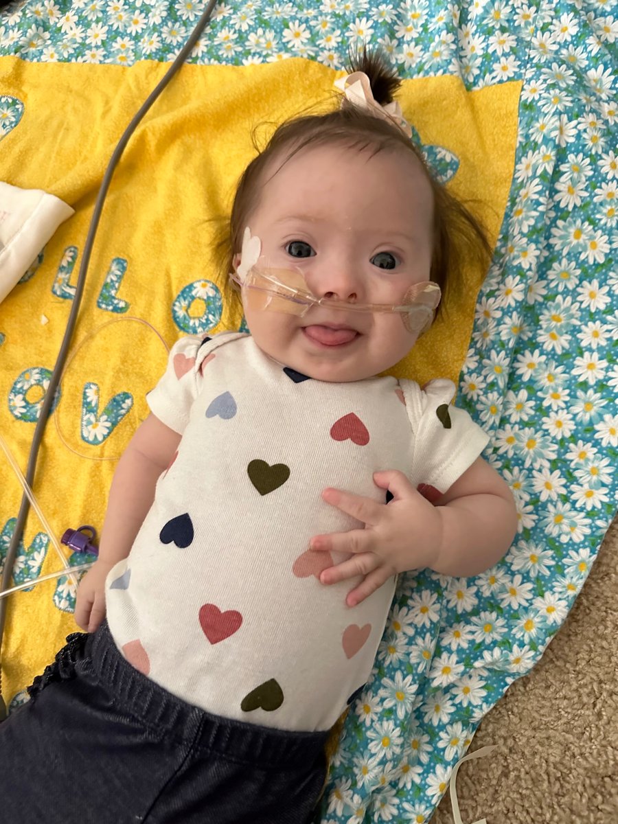 HeyMegRow's tweet image. Please pray for this sweet, perfect baby who's currently undergoing open heart surgery: my niece, Hannah. Our Lady, Undoer of Knots, pray for us!
#CatholicTwitter 
#DownSyndromeLove
#ExtraChromosomeExtraCute