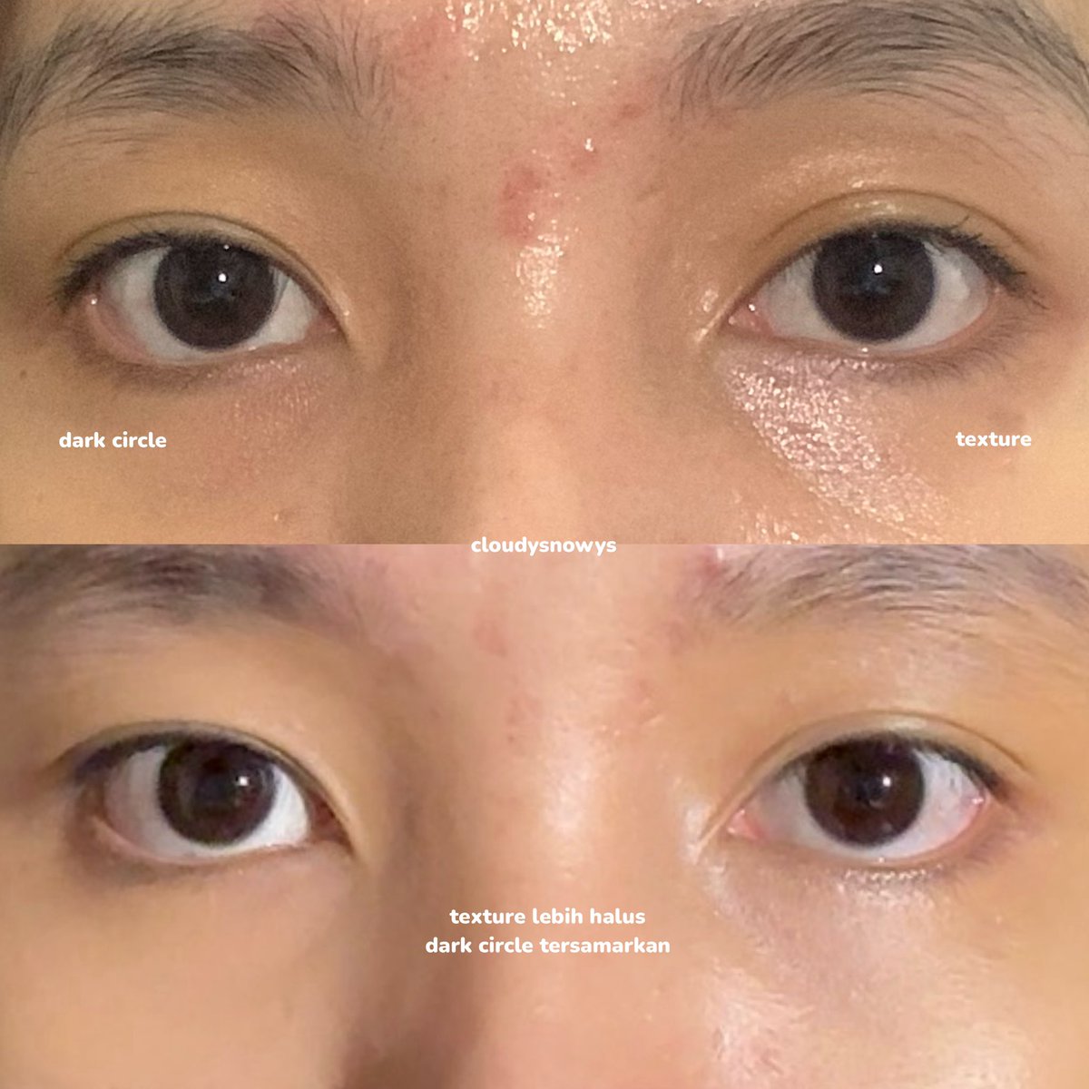 cloudysnowys's tweet photo. buat yang punya permasalahan eye dark circles apalagi buat yang sering begadang matanya keliatan lelah, must have produk ini harganya murah cuma 70ribuan aja!

my ✨life savior✨ karena bantu buat ngurangin area gelap bawah mata, bikin texture kulit area mata lebih halus🥺🤍 https://t.co/t1eFEHcNp6