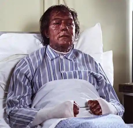 One of the Greatest TV Performances of All Time.
Michael Gambon: The Singing Detective. 
Many more great turns of course, but this is the one for me. Sardonic, pitiable, mean, self-loathing, sentimental, caustic, vulnerable, wise, kind, spiteful…all of those &amp; more at once.
RIP.