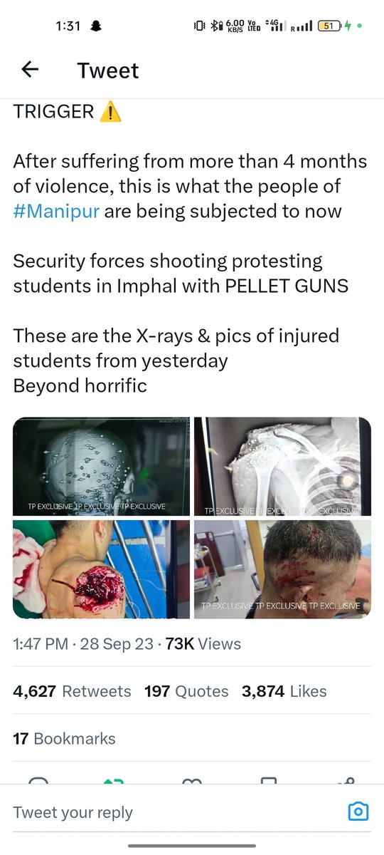 1pieceDk's tweet photo. @YourAnonCentral Plz have a look many innocents are suffering.... Human rights violation... https://t.co/0WjgsULydp