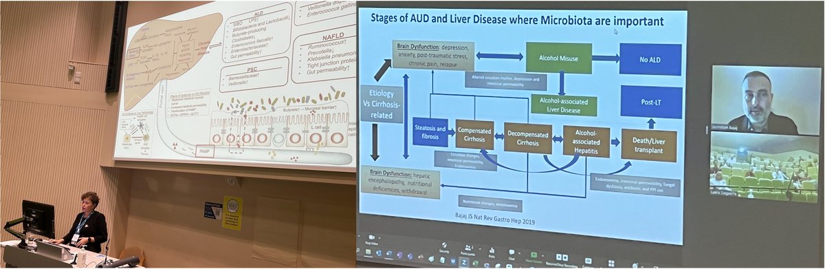 Imperial Hepatology (@ihepatology) on Twitter photo And finishing off day 2 with an overview of the gut barrier with <a href="/ForlanoRoberta/">RobertaForlano</a>, and a masterclass from the maestro of the #GutBrainLiverAxis, <a href="/JasmohanBajaj/">Jasmohan Bajaj</a> And finishing off day 2 with an overview of the gut barrier with <a href="/ForlanoRoberta/">RobertaForlano</a>, and a masterclass from the maestro of the #GutBrainLiverAxis, <a href="/JasmohanBajaj/">Jasmohan Bajaj</a>