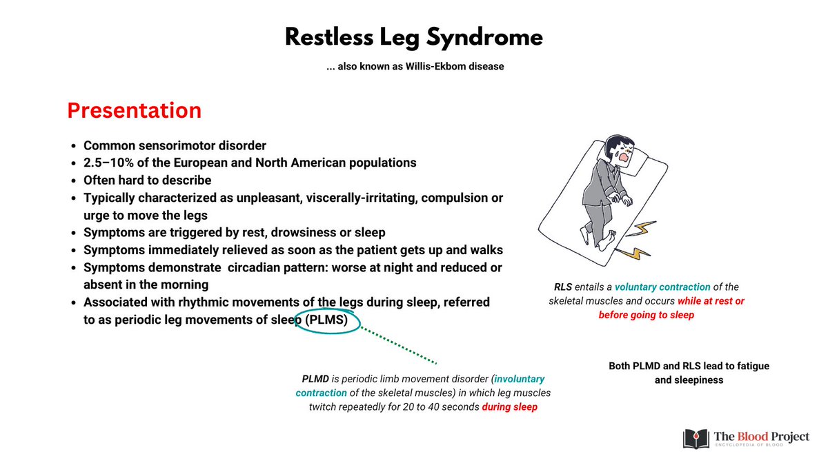 1/3 IRON IN RESTLESS LEG SYNDROME (RLS) The use of iron supplementation