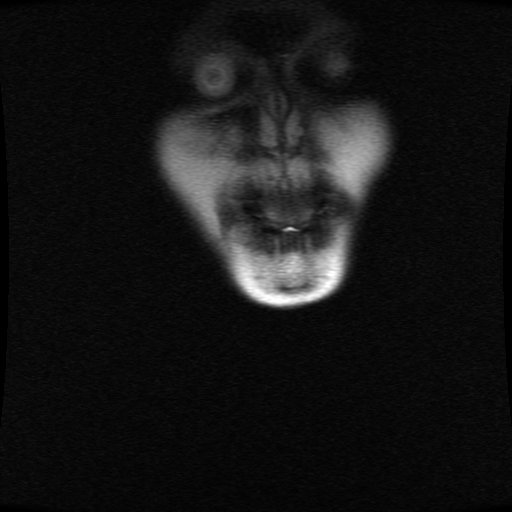 TwoCrowsPod's tweet photo. My latest MRI left me with this treasure! I will now bestow the beauty that is my face upon you all! 

#Mri #face #scans #nightmarefuel #beautyisintheeyeofthebeholder #eyes https://t.co/NrS9PgNsHB
