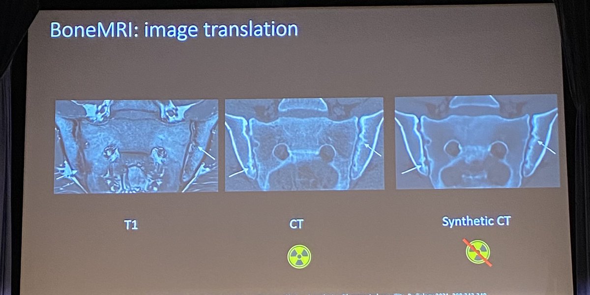 Sinead m (@sineadm15) on Twitter photo Great lecture on the possibilities AI can offer in imaging in #axSpA from Dr Lennart Jans <a href="/spondylitis/">Spondylitis.org</a>#unmetresearchneeds conference Great lecture on the possibilities AI can offer in imaging in #axSpA from Dr Lennart Jans <a href="/spondylitis/">Spondylitis.org</a>#unmetresearchneeds conference