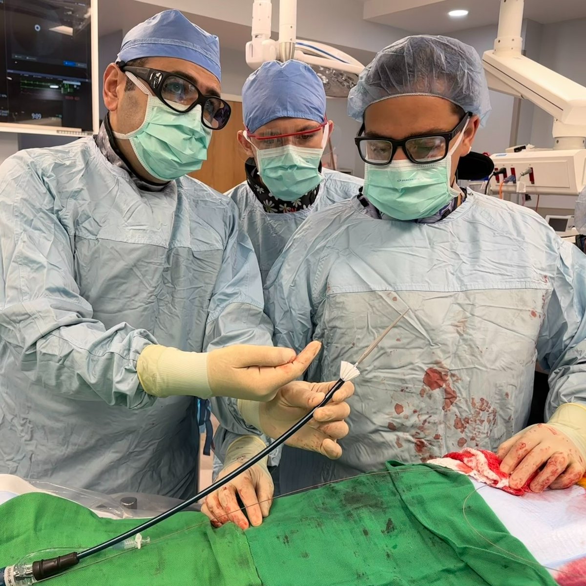 CAMCVascularIAM's tweet photo. Shadi Abu-Halimah, MD and Adrian Santini, MD worked through placement of a Candy Plug for treatment of aortic dissection. A Candy Plug consists of suturing mid graft with deployment into the false lumen to assist in false lumen thrombosis in aortic dissections. #AortaEd https://t.co/BHsupUrCVt