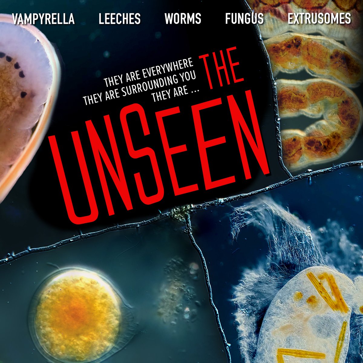 JourneyToMicro's tweet photo. Next month, we're taking a dive into the scary side of the unseen world that surrounds us. Learn about a new spooky microorganism every Monday on https://t.co/bSoRGyViJC https://t.co/map14WTD4B
