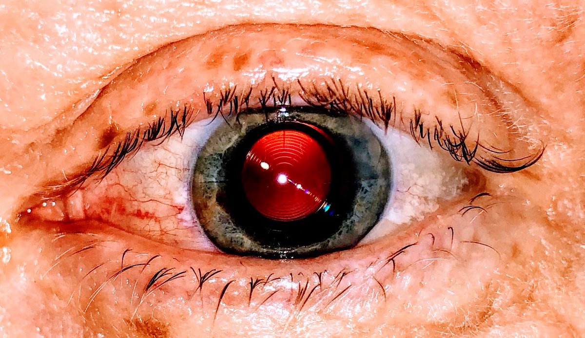 dennismjones's tweet photo. @christo4ferris I had mine done with multi-focal lenses about 5 years ago.  Colors, brightness and depth perception all came back.  20/20 vision both far and near vision.  Best thing is my tennis game improved and quality of life.  Same day picture with Sueann’s iPhone showing lens rings and RK https://t.co/lyW7F63Hoo