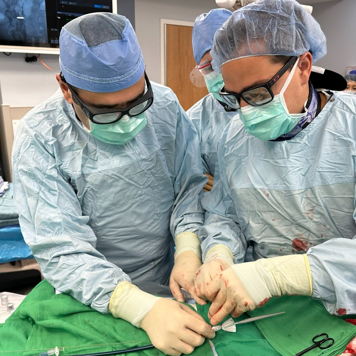 CAMCVascularIAM's tweet photo. Shadi Abu-Halimah, MD and Adrian Santini, MD worked through placement of a Candy Plug for treatment of aortic dissection. A Candy Plug consists of suturing mid graft with deployment into the false lumen to assist in false lumen thrombosis in aortic dissections. #AortaEd https://t.co/BHsupUrCVt