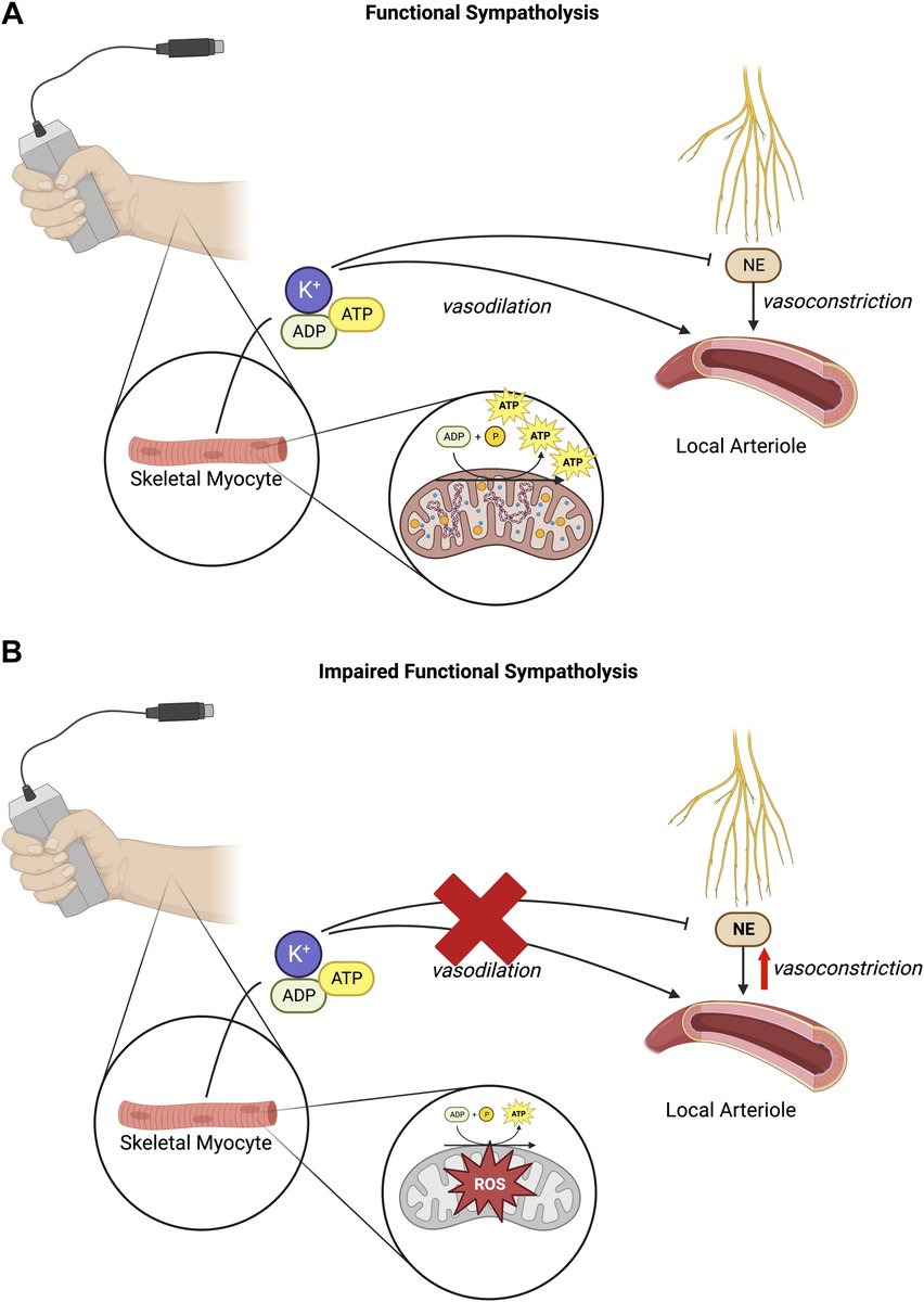 ajpheartcirc's tweet photo. Editorial Focus 🔎
Impaired functional sympatholysis during #exercise in #HFpEF: toward understanding #ExerciseIntolerance
https://t.co/IvF9ZEIeTo
@JDM_Physiology https://t.co/MIekZNayD4