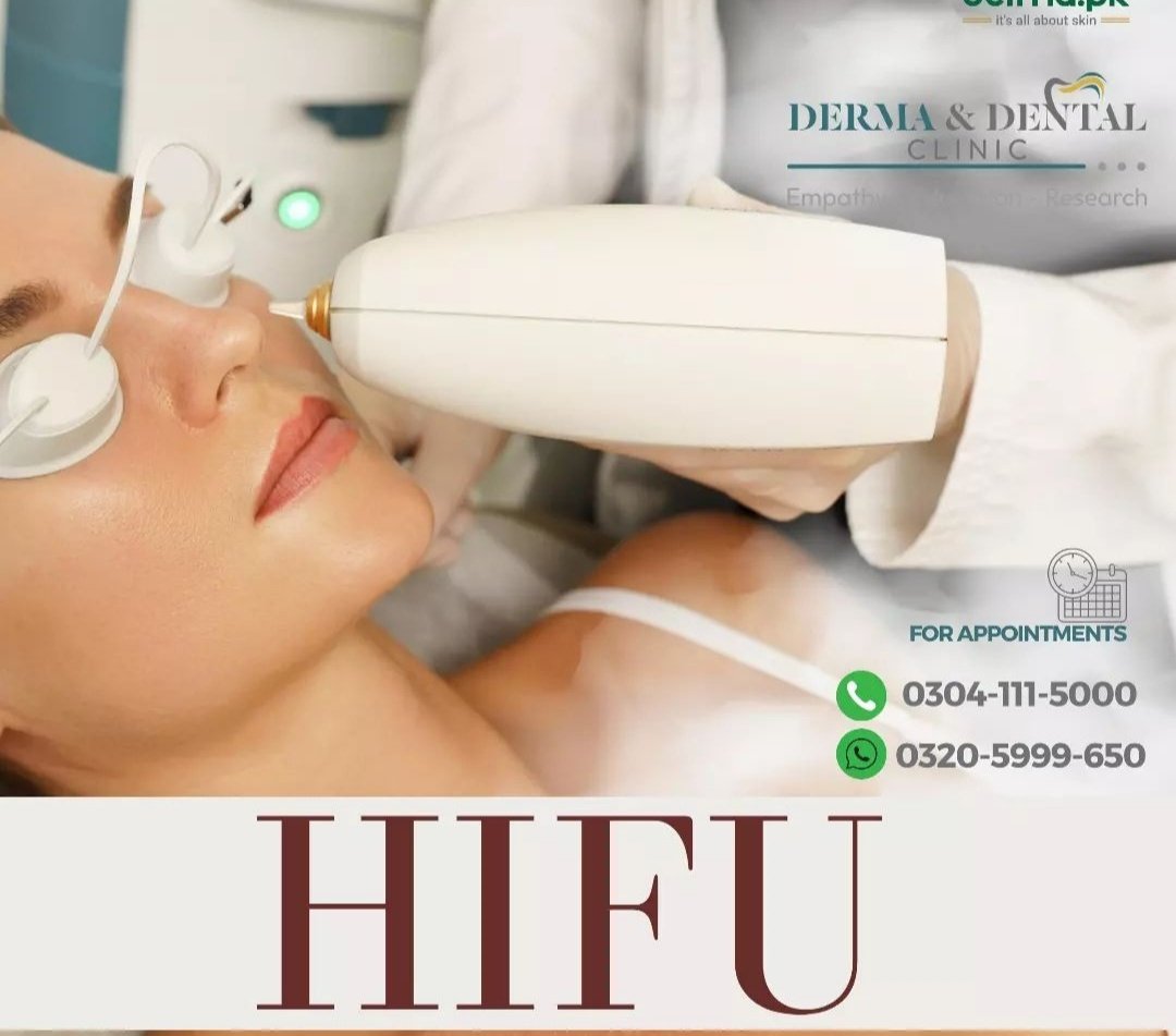 Experience HIFU (High-Intensity Focused Ultrasound) at Dr. Navaira Tariq's Lahore clinics for non-surgical skin tightening and lifting. Achieve natural results without downtime. Contact us at  0304-1115000 or 0320-5999650 #HIFU #SkinTightening #YouthfulSkin #AestheticTreatment