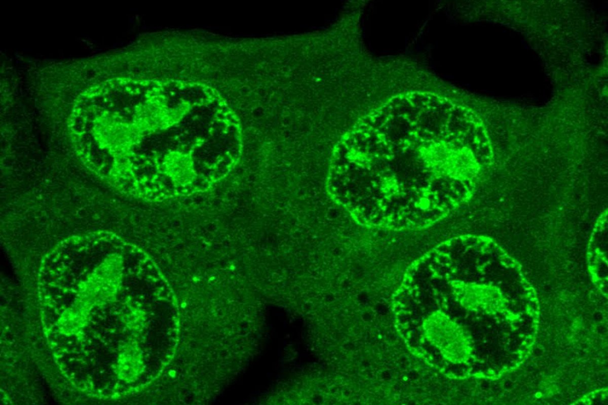 Whitehead Institute (@whiteheadinst) on Twitter photo “Our work suggests that if you want to develop a very efficacious drug, then you should know where the target of the drug is in the cell with respect to these compartments,” says <a href="/youngricka/">Richard Young</a>.
ML helps predict where drugs accumulate in the cell: wi.mit.edu/news/machine-l… “Our work suggests that if you want to develop a very efficacious drug, then you should know where the target of the drug is in the cell with respect to these compartments,” says <a href="/youngricka/">Richard Young</a>.
ML helps predict where drugs accumulate in the cell: wi.mit.edu/news/machine-l…