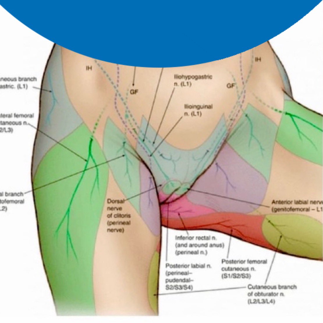 #UnidadDeDolor 
🔵 Dolor pélvico crónico 🔵

La inervación sensitiva de la zona pélvica es compleja. 

Los casos de dolor pélvico crónico deben evaluarse por profesionales expertos.

👉 EDOLOR.com