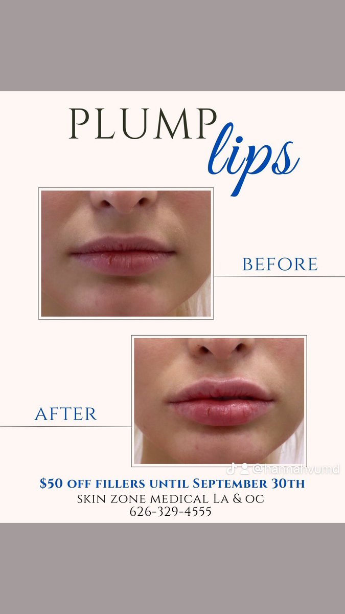 skinzonemed's tweet photo. $50 off all fillers for the month of September
Filler in the lips can help plump,soften &amp; give color to the lips
👄 Say yes to more collagen

🗓️Schedule your appointment today
626-329-4555
714-361-1555 https://t.co/eXCQdqj2QL