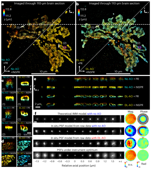 Really cool paper out today from the Chubykin, Landreth, and Huang labs on deep learning driven AO for super-resolution SMLM at depth in tissues. 🤩nature.com/articles/s4159…