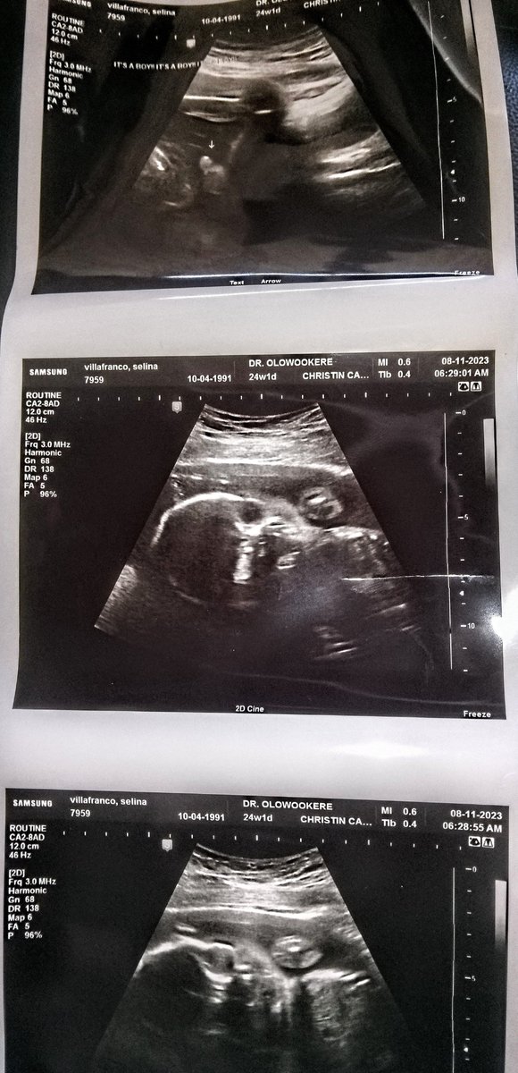 DonSel91_'s tweet photo. Baby number 3 dues Nov 30th https://t.co/4RoCi7zDPd