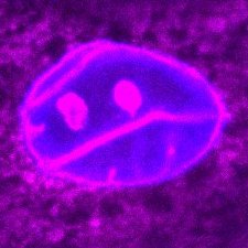 Simpson Lab @UWMedicine tweet media