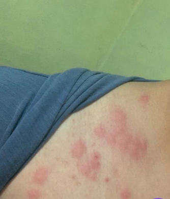 lasillarota's tweet photo. ⚠️ #ÚLTIMAHORA ¡Cerraron la Facultad de Química de la #UNAM! Reportan plaga de  chinches https://t.co/hoZuzzeYYL https://t.co/Pee11RUFuU