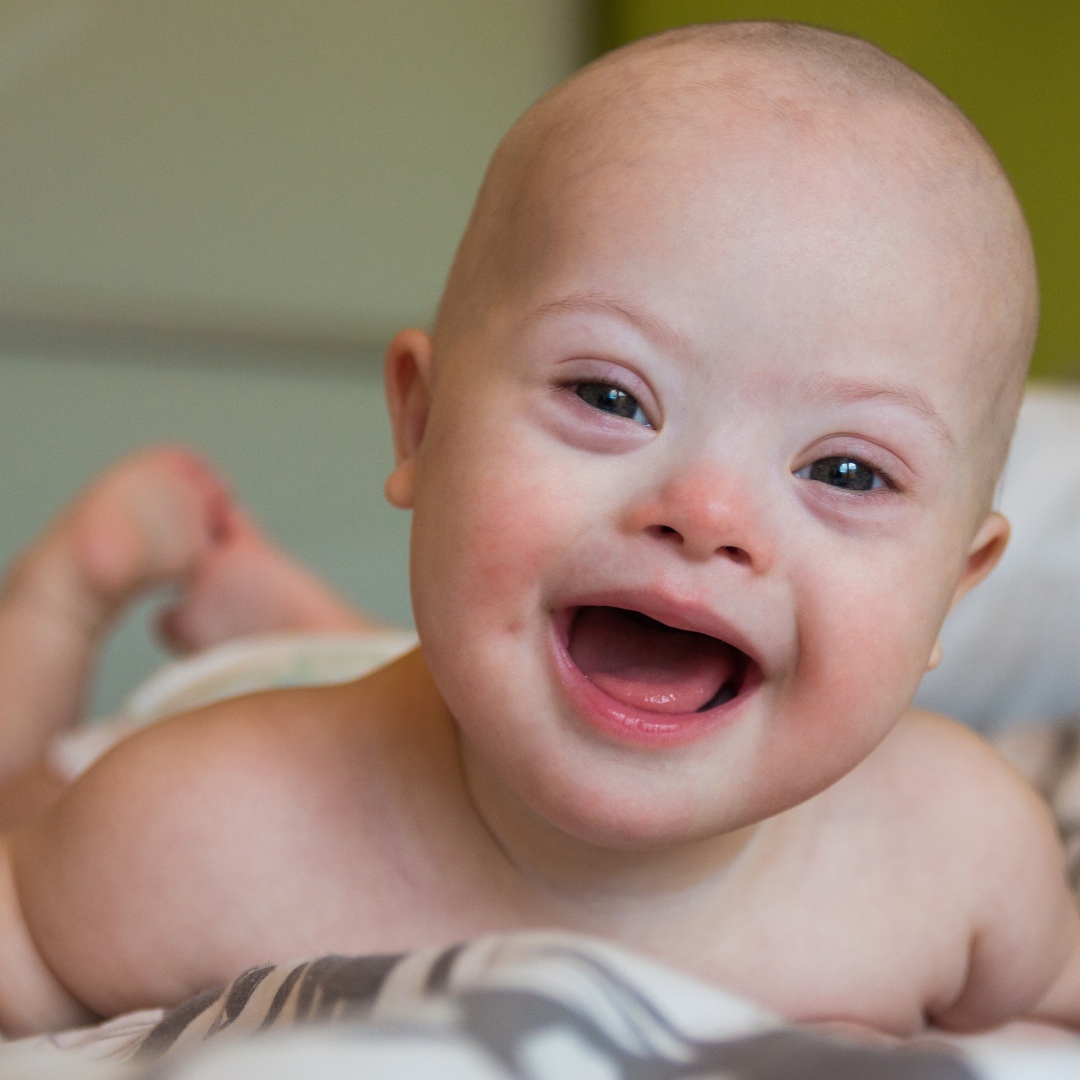 sensorybegin's tweet image. Tummy time is a beautiful sensory experience.  It provides the baby with an opportunity to explore vestibular, proprioception, tactile, vision.
We begin to make sense of the world through our senses.
#sensory #sensation #tummytime #play #sensoryintegration #sensoryprocessing