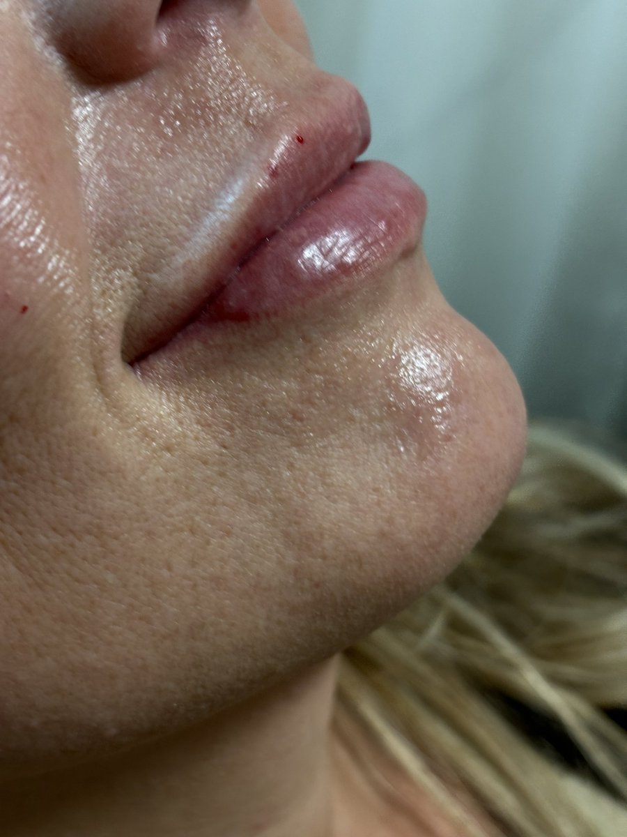 hankenzie's tweet photo. Stopping by to share my new skill. 
Come to me for the perfect pout. 👄
Before —> After https://t.co/WuPE1f1NRg