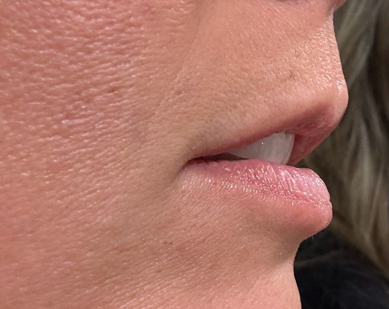 hankenzie's tweet photo. Stopping by to share my new skill. 
Come to me for the perfect pout. 👄
Before —> After https://t.co/WuPE1f1NRg