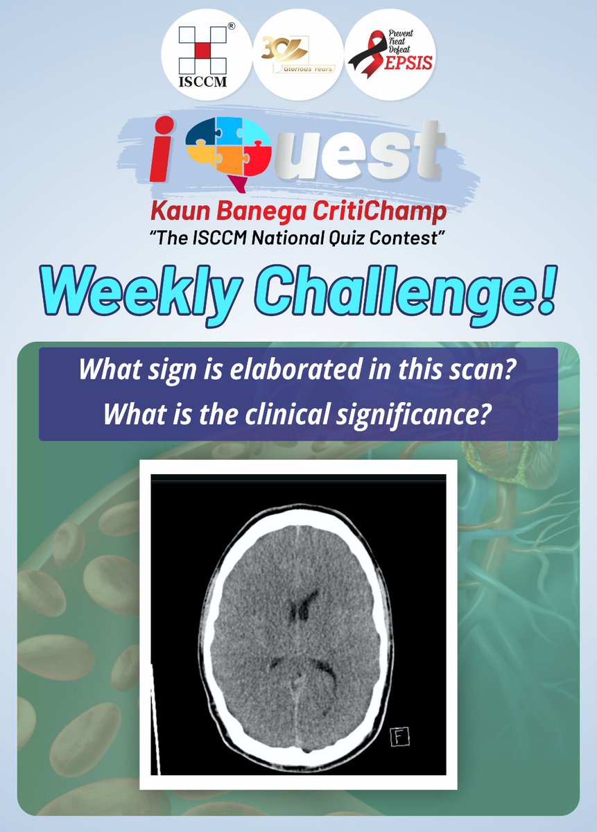 isccmnational's tweet photo. #question
#iquest
#weekly challenge
#isccm https://t.co/i7obm8T6P5