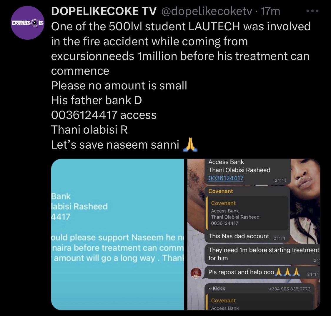 K_Basharr's tweet photo. Good morning. Salaam alaykum.
Thani is a 500lvl student of LAUTECH  involved in a fire accident while returning from an excursion. N1million naira is needed for his treatment.
Please no amount is small 

0036124417 Access Bank
Thani olabisi R

Let’s save Naseem Thani https://t.co/qkhhVHQp6g
