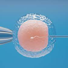 theeggman68's tweet photo. Can we improve the way we perform ICSI?🧐
I think we can!👍
Looking forward to debating this topic today at the ARCS Symposium with Dr Rachel Gregoire, refereed by ARCS Chair JKB @DrMotility @ARCScientists @XYFertility #ICSI #clinicalgovernance #IVF #assistedconception #debate https://t.co/eZfNdkPeJC