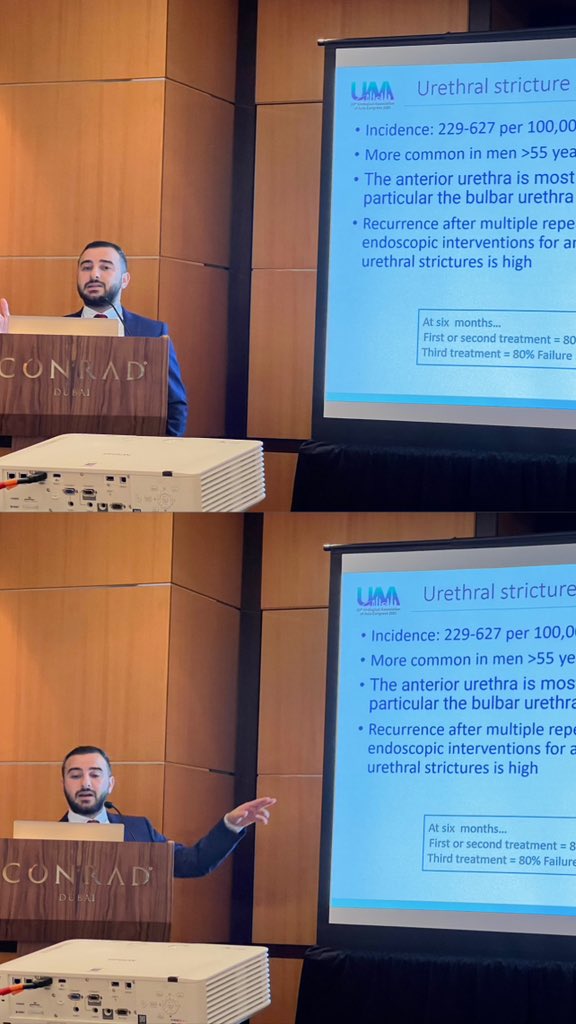 Presenting the successful outcomes of Optilume treatment for urethral strictures at @FrimleyUrology by Mr Andrew Chetwood at @uaa2023 in Dubai #UroSoMe #Urology