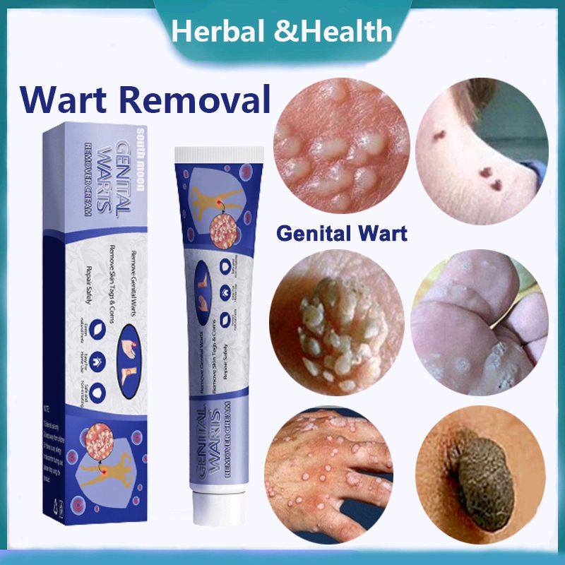Roybalboa0610's tweet photo. Check out Wart Removal Cream Genital Wart Removal Cream Mole Skin Tag Remover Mole Mole Repellent 克疣膏20g for RM7.90 - RM29.90. Get it on Shopee now! https://t.co/QBZ1w46gQp https://t.co/05umgzuHUG