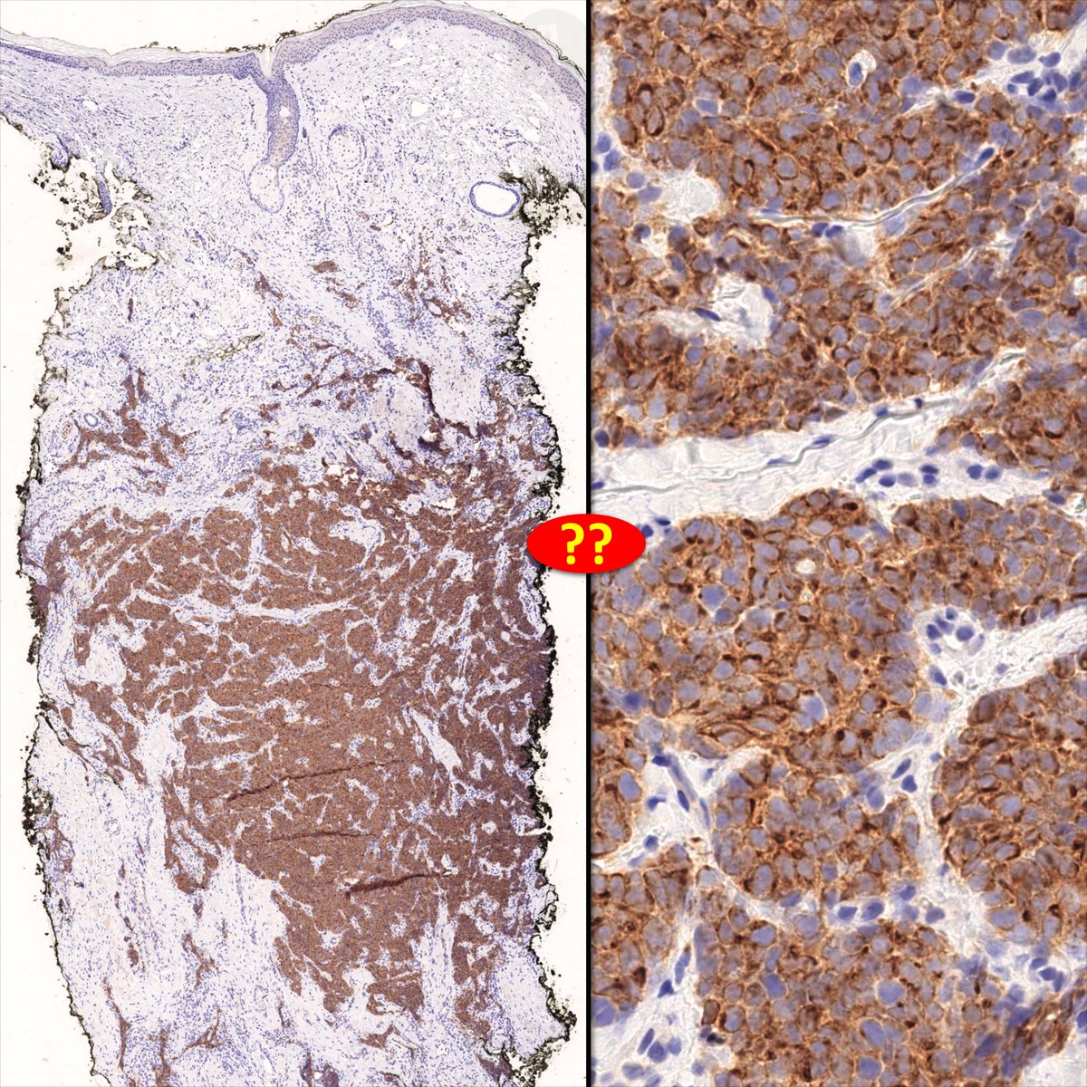 Charlie Herndon tweet media