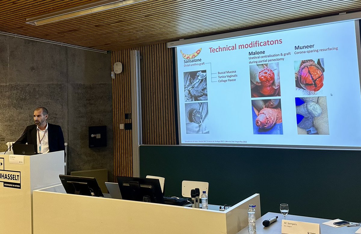 #gettingthingsright meeting goes on with #penilecancer. @MaartenAlbersen is showing the results of surgical technique and outcomes following coronal-sparing glans resurfacing 👉 rdcu.be/dnlOw