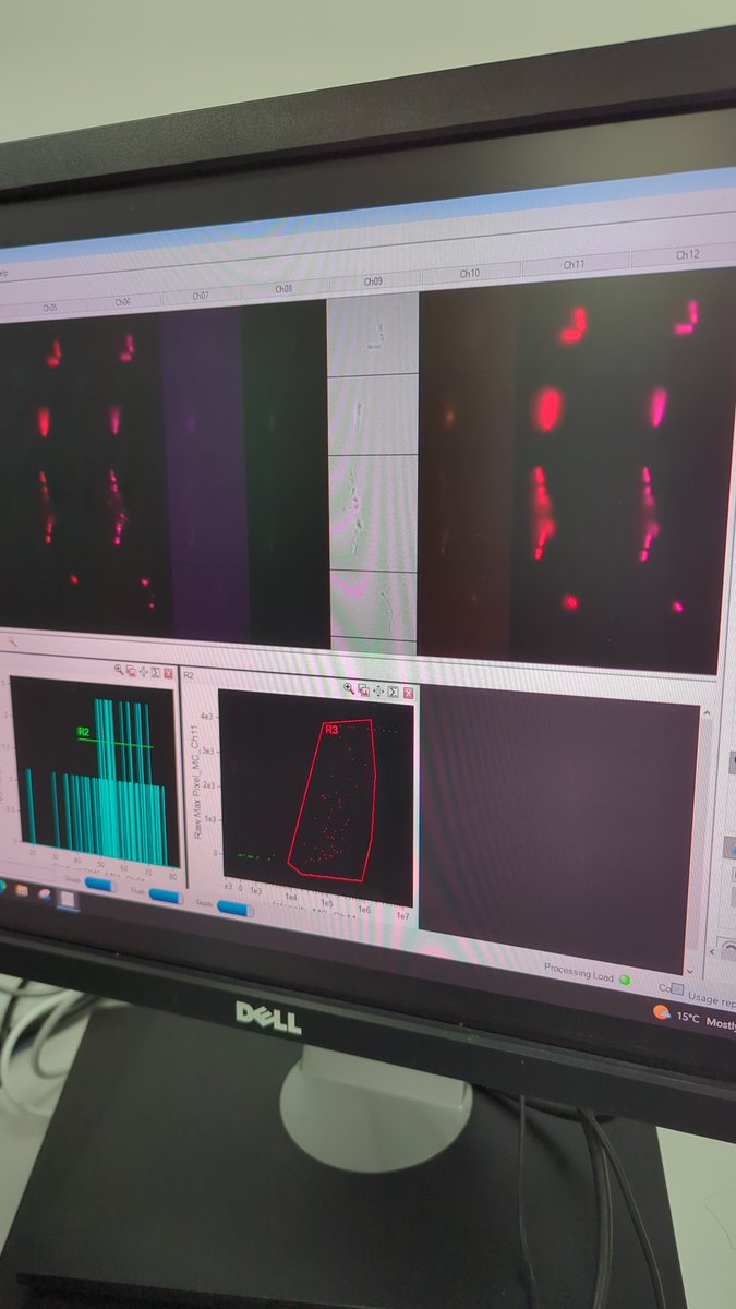 SteveServin7's tweet photo. Shine my beautiful bugs, shine! #imagecytometry at @NewcastleFCCF with their amazing team on my last day here. I want to thank this beautiful group that made my stay amazing and of course Dr Filby, my Mentor thanks to the @RoyalMicroSoc program and thanks @MI_TechTalent !!! https://t.co/PMAqaLqSPG