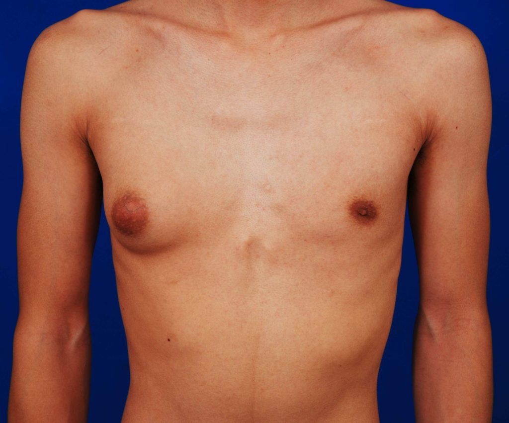 A teenager who is perfectly fine.
No disease. No drugs.
What is the diagnosis ?
#MedTwitter