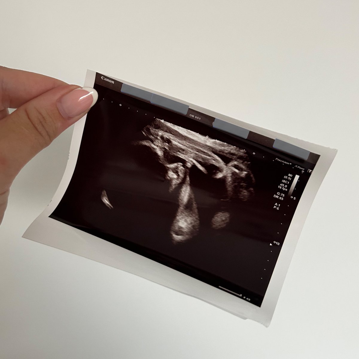 Baby B due in November 👶🏼💙

Got to see him again this morning he’s running out of space. No idea how I’m still waddling around teaching dance and PE, my hips are definitely being put through their paces! 

Any tips for preparing for maternity leave are welcome 🤰🏼🙏🏼