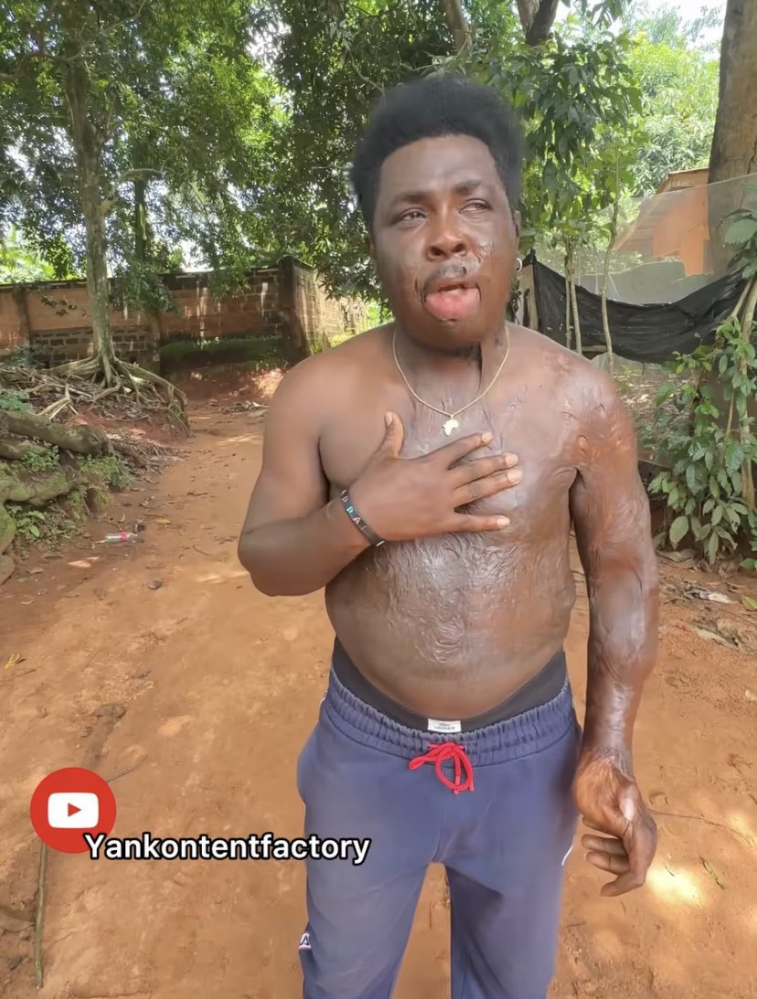 BishopPOEvang's tweet image. 😡😡😡😡😡😡😡😡😡😡😡😡😡😡😡
Omo this is so sad.
This man trained his girlfriend in university and also opened supermarket for the mother and he was dumped after all the things he did for them because of his body condition.😱
Get a translator