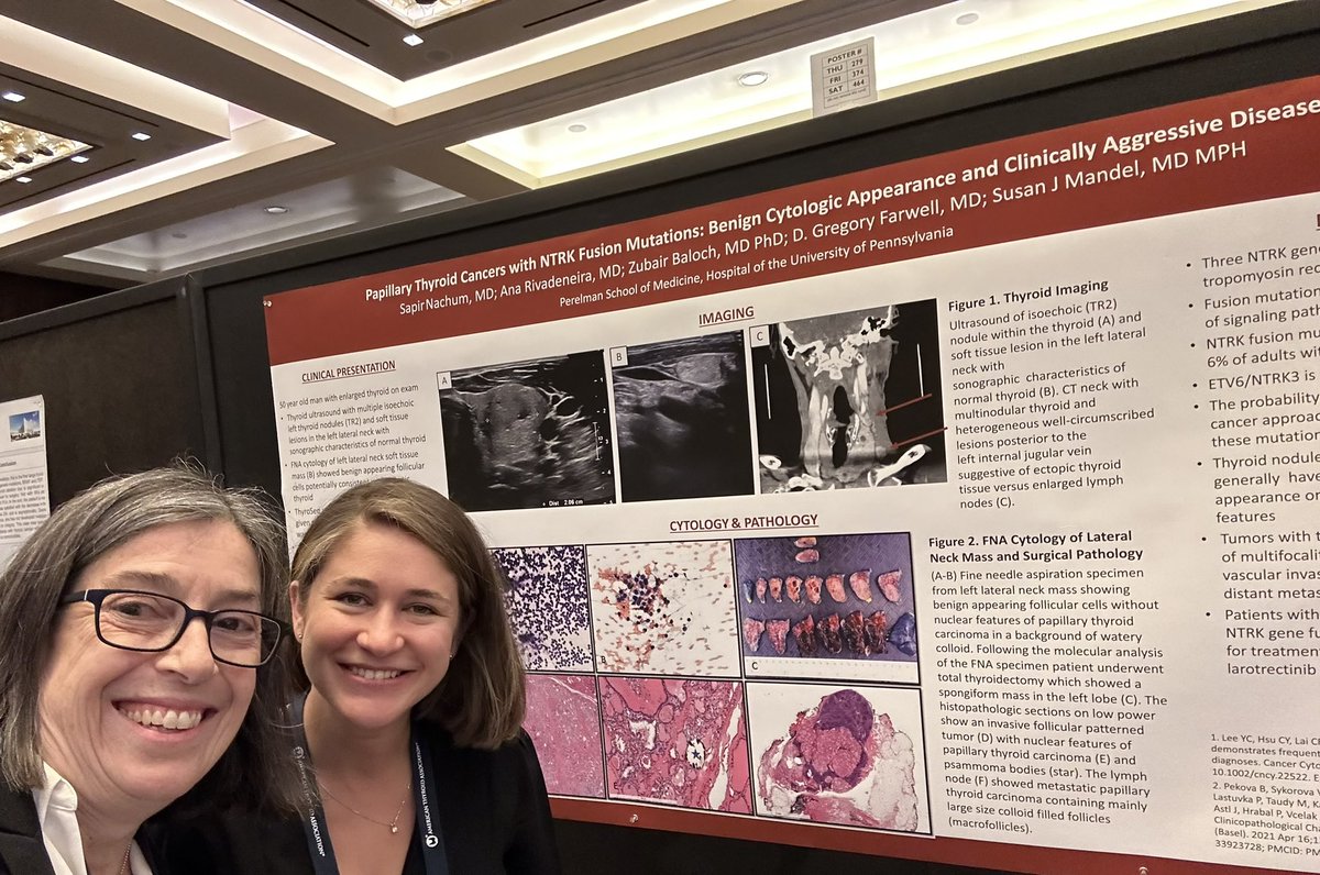 PennEndocrinology (@pennendocrine) on Twitter photo Second year fellow @sapir.nachum.goldberg presented a poster on behalf of <a href="/adcrr/">Ana Del Carmen Ramir</a> and @sjmandel525 and others at the @amthyroidassn conference this week in Washington DC. It was recognized as an Outstanding Trainee Poster by the American Thyroid Association. Congrats! Second year fellow @sapir.nachum.goldberg presented a poster on behalf of <a href="/adcrr/">Ana Del Carmen Ramir</a> and @sjmandel525 and others at the @amthyroidassn conference this week in Washington DC. It was recognized as an Outstanding Trainee Poster by the American Thyroid Association. Congrats!