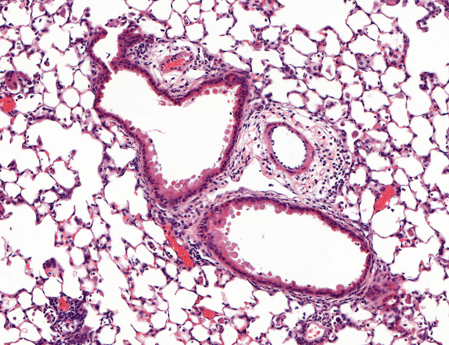 Unexpected findings in wildling mice challenge a popular idea that allergies emerge from overreactive and bored immune systems without sufficient exposure to microbiota, due to today’s strict hygienic practices. @SRosshart scim.ag/4hX