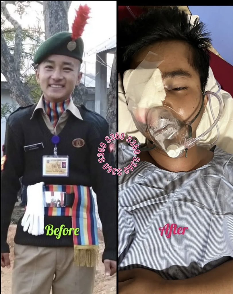 Is this the conduct of what's often referred to as the most disciplined army in the world? If you genuinely believe they are disciplined, how can you explain this? Innocent young students are subjected to life-altering injuries, and if they survive, it's merely for demanding