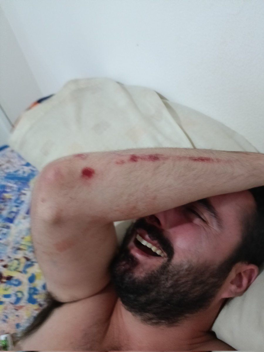 El pasado lunes, en el parque de Peñuelas un chico que me acompañaba y yo sufrimos una agresión al grito de: ¡Maricones! Volvíamos a casa, faltaba una calle y 4 individuos nos empezaron a increpar. Intentamos avanzar más rápido pero corrieron y nos rodearon...