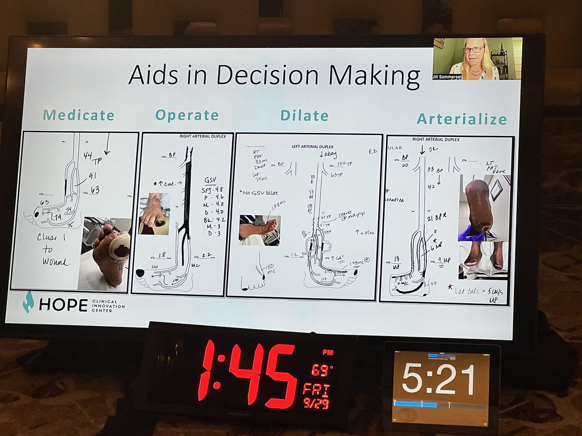 monteromiguel's tweet photo. This slide is just brilliant. Thank you @JillSommerset. Wonderful video sessions at @ALPSlimb #DFCon2023 #ultrasoundfirst #HOPE #HOPEstories @DGArmstrong https://t.co/bRuFVSOyjC