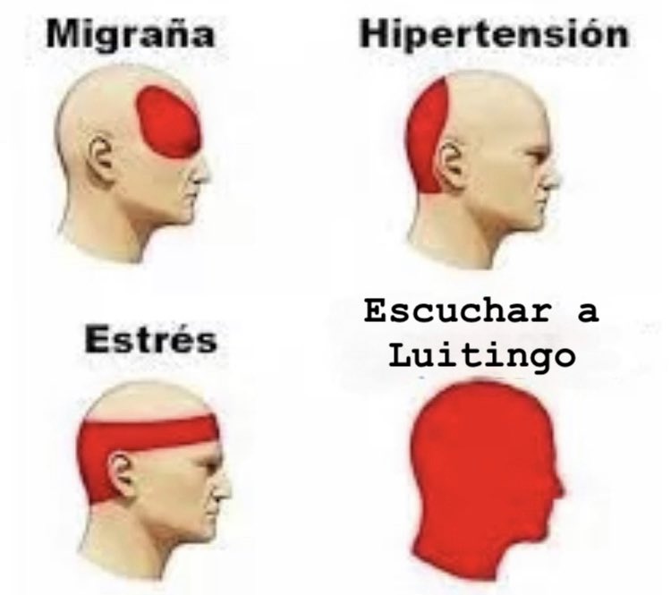 adarauva's tweet image. Tipos de dolores de cabeza.

 #GHVIP29S