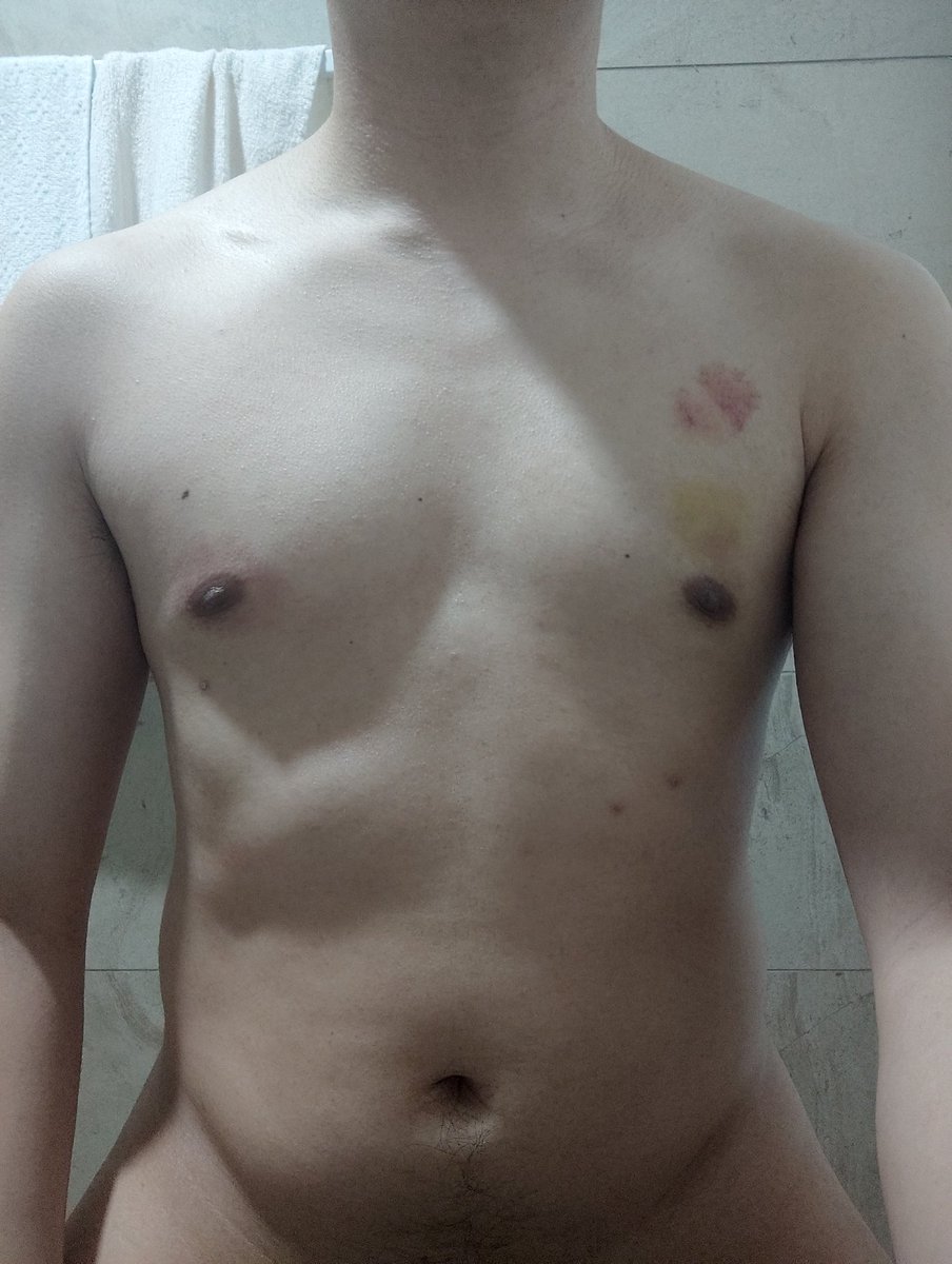 Just as one love bite healing, same guy who gave it to me the first place decided to add 2 more. Can't say I dislike it hahaha