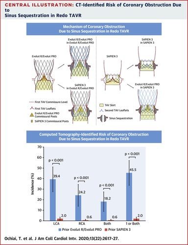 @Murmur_MD Neo skirt, sinus sequestration, coronary reaccess. All more problematic with Evolut compared to SAPIEN. And now with Resilia the hemodynamic advantage is no longer there. So why would anyone put an Evolut in a low risk patient? 🤷‍♂️ #TAVR