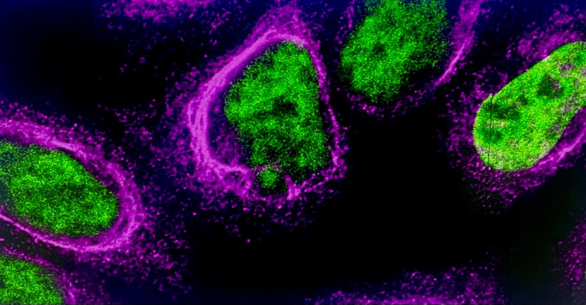 Guess who?? @LJSeabrook @HobbsDermLab @harvardmed #FluorescenceFriday @UCI_SPPS @UCIBioSci