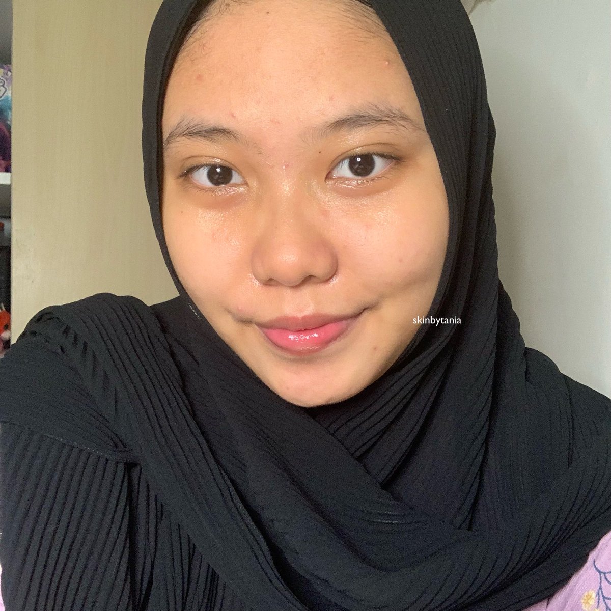 skinbytania's tweet photo. Pertama ini aku of course pake cleanser nya, aku mau liatin dulu nih before dan afternya:

Langsung keliatan SEGER muka akuu! Feelsnya juga enak ga bikin kering dan membersihkannya oke juga! https://t.co/le5MWOyPpC