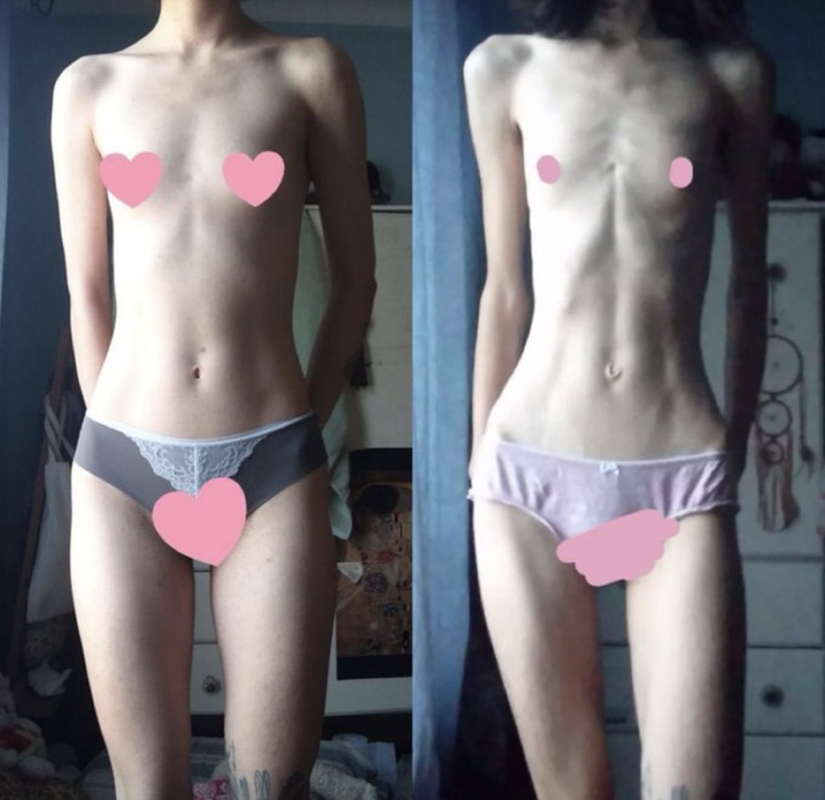 marchrexic's tweet photo. would any1 want a thread of beforw and afters but the before’s are all irl skinny/already uw? like this one   
╱|、
(`   -  7
 |、⁻〵
じしˍ,)ノ https://t.co/CiNLNO5gZU