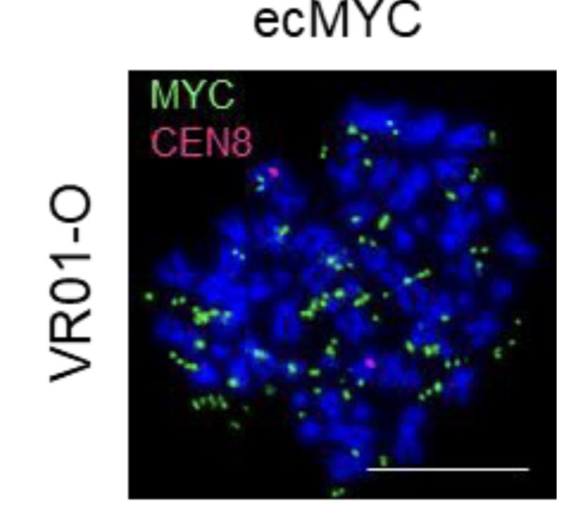 Anirban Maitra (@aiims1742) on Twitter photo ecDNA in #PancreaticCancer!
Perfectly timed preprint with #AACRPan23 from <a href="/PancreasVerona/">Pancreas Verona</a>:
ecDNA amplification of MYC drives intratumor copy-number heterogeneity and adaptation to stress in PDAC.
biorxiv.org/content/10.110… ecDNA in #PancreaticCancer!
Perfectly timed preprint with #AACRPan23 from <a href="/PancreasVerona/">Pancreas Verona</a>:
ecDNA amplification of MYC drives intratumor copy-number heterogeneity and adaptation to stress in PDAC.
biorxiv.org/content/10.110…