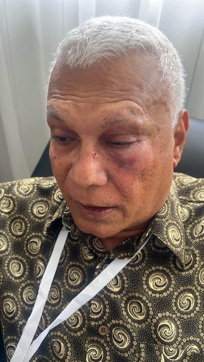 AdhadhuMV's tweet photo. ރައްޔިތުން މަޖިލީހުގެ އައްޑޫ މަރަދޫ ދާއިރާގެ މެންބަރު އިބްރާހިމް ޝަރީފަށް ގްރޫޕަކުން ހަމަލާ ދީފި، ޝަރީފް "އަދަދު" އަށް ވިދާޅުވީ ހަމަލާދީފައިވަނީ މެންހަޓަން ހޮޓަލް ތެރޭގައި ކަމަށް. 

ލައިވް ބްލޮގް: https://t.co/0EOQ3uoAix https://t.co/bKypz2wXzD