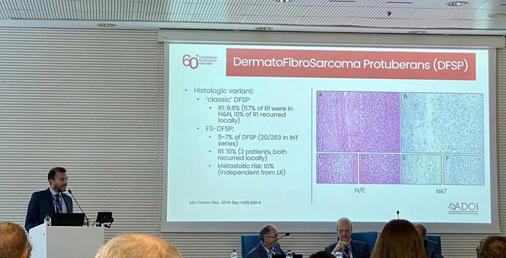 Reviewing the intricate world of #SkinSarcoma at the @DermatologiADOI National Congress. 🩺 #Sarcoma can puzzle multiple specialists, highlighting the importance of cross-disciplinary collaboration! 👩‍⚕️👨‍⚕️ #dermatology @ItaSarcomaGroup @ChirSarcomi_INT